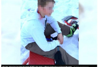 13岁少年滑雪遭袭击 被滑雪杖刺穿头骨