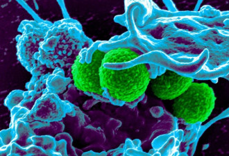 超级病菌：墨尔本科研者们发现新抗生素