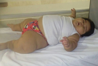 10个月大婴儿重达60斤 月子里穿2岁童装