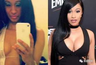 屁股疼炸、双脚肿成馒头，Cardi B再也不整形了