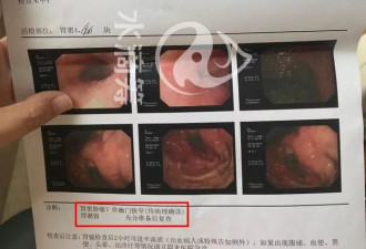 萧山姑娘筹款称爸爸诊胃癌 几天后却在微博炫富