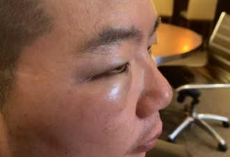 美华裔女童遭非裔性骚扰 家人阻止反遭暴力殴打