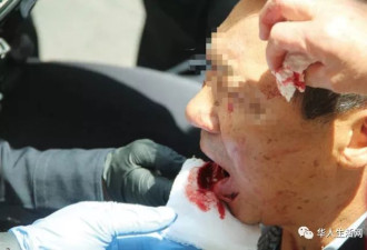 血迹斑斑！中国游客旧金山闹市遭暴打砍杀
