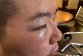 调戏华裔女童家长要求道歉，反遭非裔大妈殴打