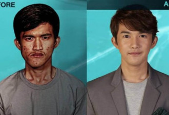 泰国丑男赴韩国整容变帅，亲妈都认不出