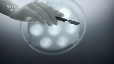 央视悄悄拍部纪录片：手术室背后 藏着多少秘密