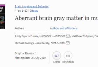 扫描大脑预测犯罪 科学发现杀人犯脑部灰质较少