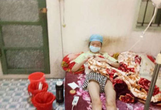 三年水米不进 目前已找到医生愿尝试医治