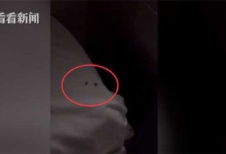 孩子吊针躺病床上称有虫咬 妈妈掀开被子惊呆了