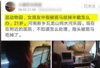 女子游乐园内被斑马咬掉手指 园方无法确认原因