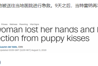 女子被迫截去手脚 只因伤口曾被爱犬舔舐