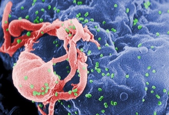 艾滋病免疫希望?新疫苗今年将开展千例人体试验