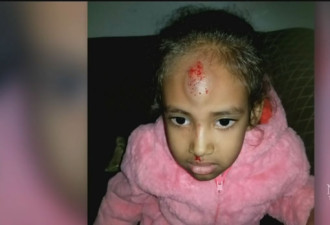 多伦多五岁女童被人推下校巴 脑门磕伤