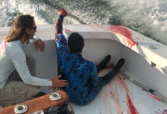 吓呆！男子潜水左手遭鲨鱼咬烂 血流如注爬上船