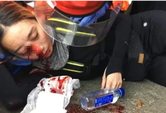 香港警察1米内扫射，女子“眼球破裂”失明
