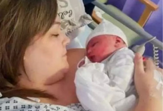 女子剖腹产子 男婴刚取出似外星人！医生：天呐