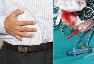 韩国男子手术后发现纱布残留腹中 医生反咬一口