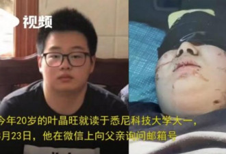 留学生被华裔绑架10天 面部惊现血洞惨不忍睹