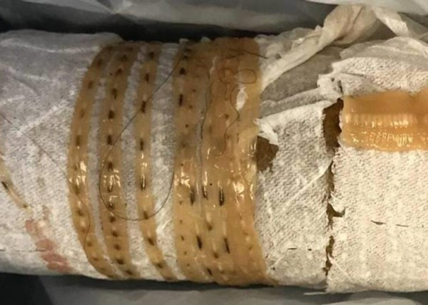 男子天天吃三文鱼刺身竟排出1 6米绦虫 无忧资讯