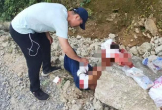 广西桂林一客车翻下山崖致3死11伤过路医生救人