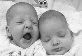 这对2010年出生的姐妹 已成“世界最美双胞胎”