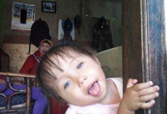 印尼小女孩患罕见病眼球天生能变4种颜色