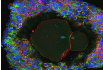科学家首次成功在实验室里培育出人类卵细胞