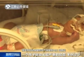 双胞胎姐妹在妈妈肚子里抢血 所幸医生当机立断