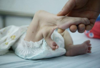 高龄产妇不听劝告执意生孩子,看到孩子后大哭
