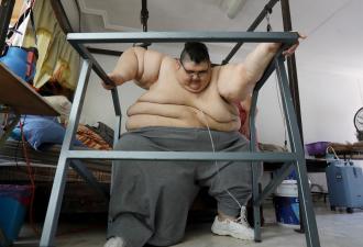 成功减250公斤 世界上最重的人站起来了