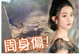 赵丽颖全身是伤站不住，体重不足80斤