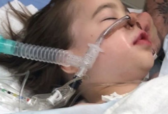 加拿大女孩去医院拔了颗牙后 肺部衰竭