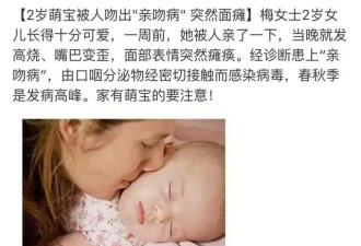 千万别随意亲孩子！2岁宝宝竟被亲吻致面瘫…