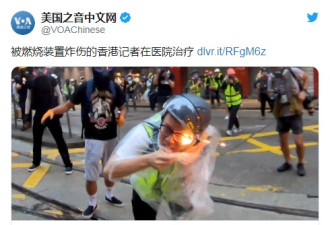 被燃烧装置炸伤的香港记者，现在正在医院治疗