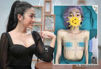 越南美女因颜值高身材爆红网络，却自曝曾整形