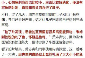 60岁大爷喝了两碗鱼汤 体内竟扎上百根鱼刺