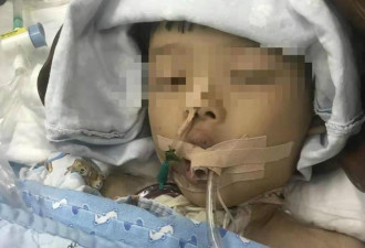 5岁男童幼儿园疑似误食老鼠药中毒去世
