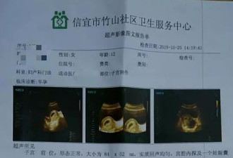 12岁智障女孩8个月内再遭性侵怀孕，各方回应