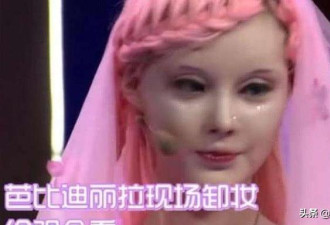 浙江女孩痴迷芭比娃娃，不惜在脸上割了108刀