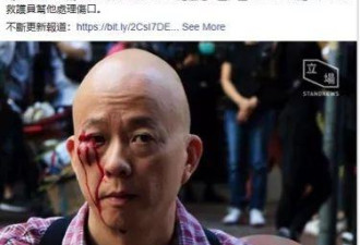 泛民派的港籍台媒记者，也被港青殴打了