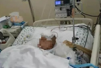 被高空坠物砸中的4岁男童仍在ICU！妈妈的举动