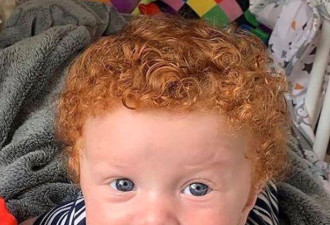英国一家人都是黑发，生出一个红发小宝宝
