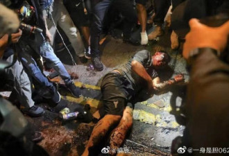 大陆游客在香港被残忍私刑 本人发声