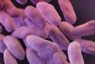 全美27州发现超级细菌 传播后果不堪设想