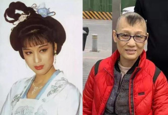 “第一古典美人”身患癌症容颜憔悴
