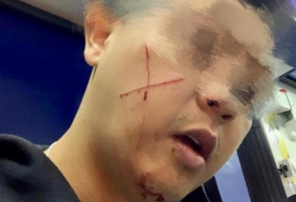 休班港警脸部遭划“十字”，一男子被捕