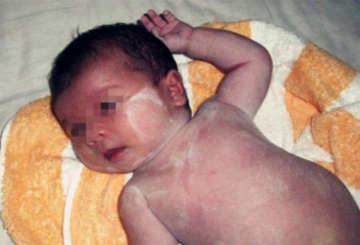 8个月大的宝宝罹患脑瘫，这种气味是罪魁祸首