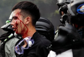 香港女孩向警察男友摊牌：不辞职我们就分手