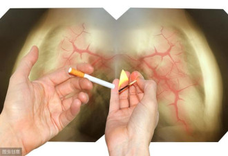 烟瘾大的人，这4个时间段不抽能减少对肺部损伤