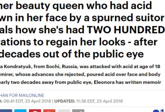 俄选美小姐被泼酸毁容 历经200次手术重塑容颜